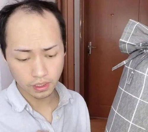 莘县秃头网红,莘县现象背后的社会文化解读