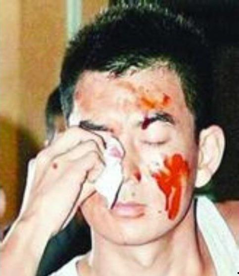 明星拍戏时撞头,明星拍戏意外撞头，安全第一警钟长鸣